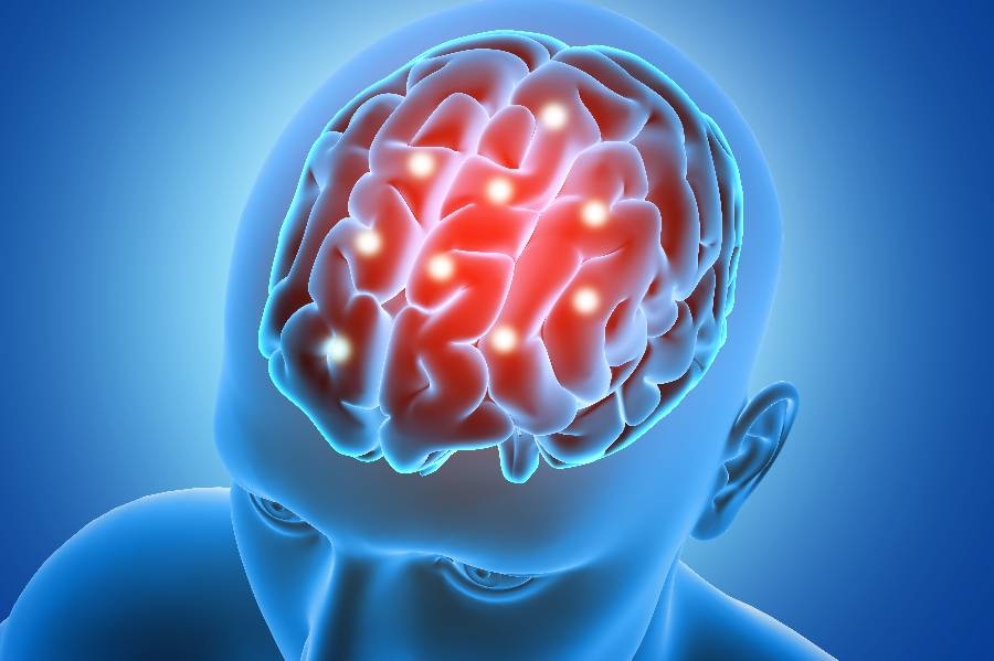 Dirençli Epilepsi